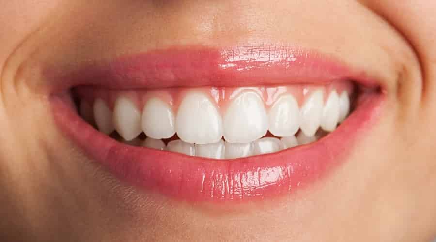 sparkling-dental-smile-perfect-smile